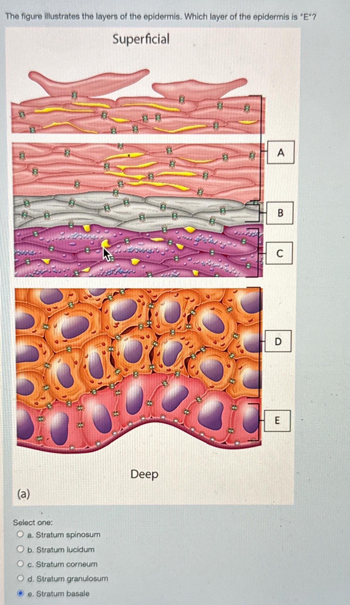 Solved The figure illustrates the layers of the epidermis.
