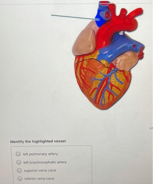 Solved LT Identify the highlighted vessel. left pulmonary