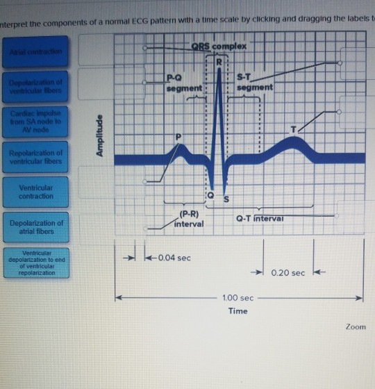 solved-nterpret-the-components-of-a-normal-ecg-pattern-with-chegg