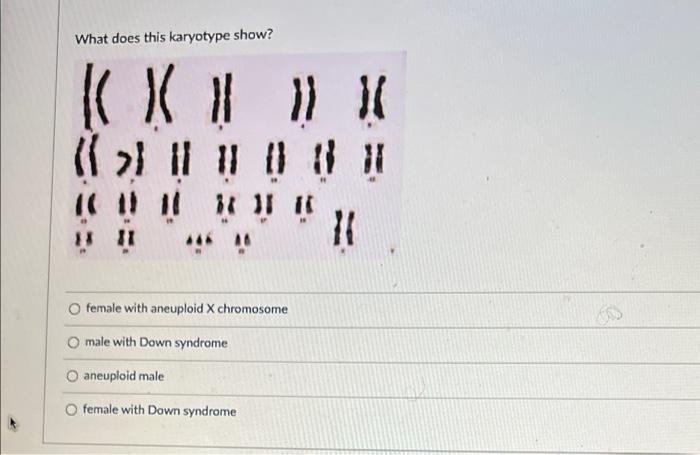 Solved What does this karyotype show? KX !! » Il lil 11 i 11 | Chegg.com
