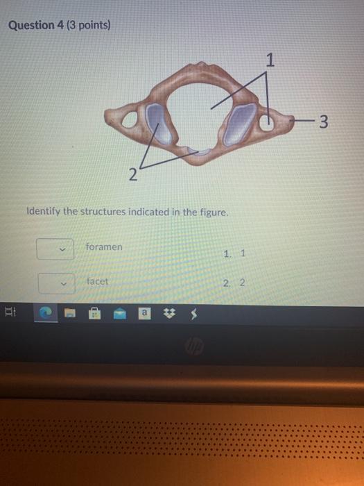 Solved Question 4 (3 points) 1 3 2 Identify the structures | Chegg.com