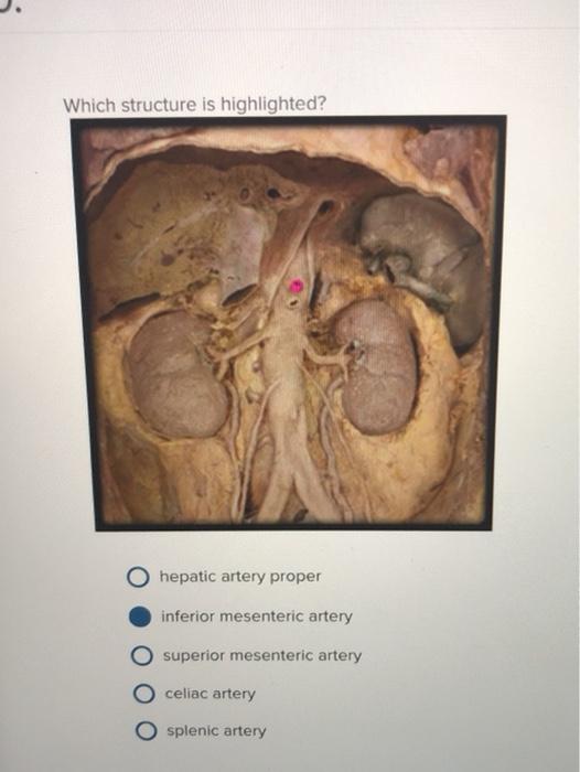 Which structure is highlighted? hepatic artery proper inferior mesenteric artery superior mesenteric artery celiac artery O s