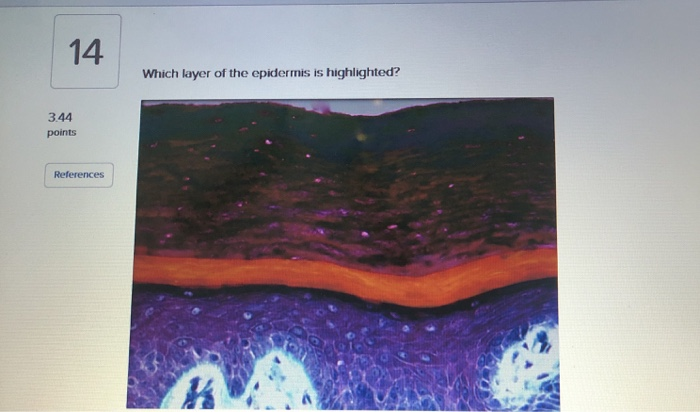 Solved 14 Which layer of the epidermis is highlighted? 3.44 | Chegg.com