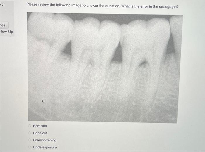 N
tes
llow-Up
Please review the following image to answer the question. What is the error in the radiograph?
O
Bent film
Cone