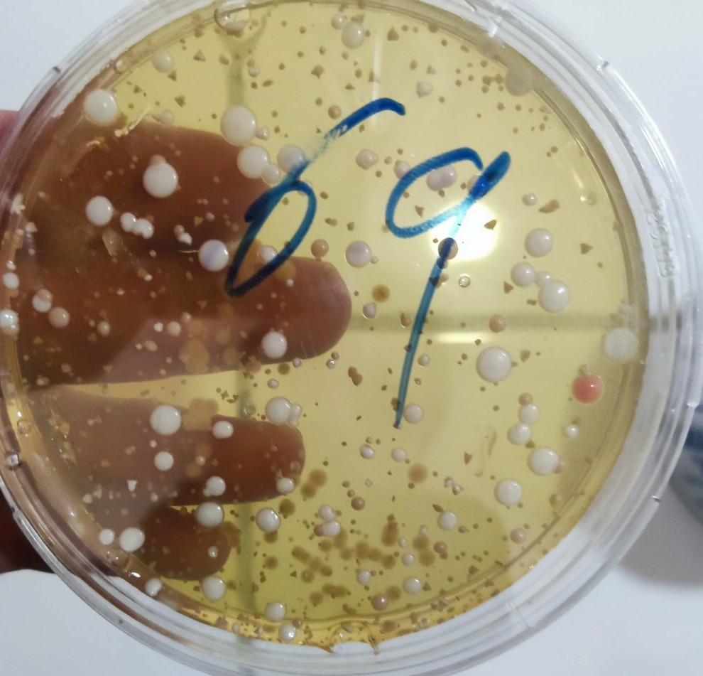 Solved Based on these images, is the sample Candida spp? The | Chegg.com