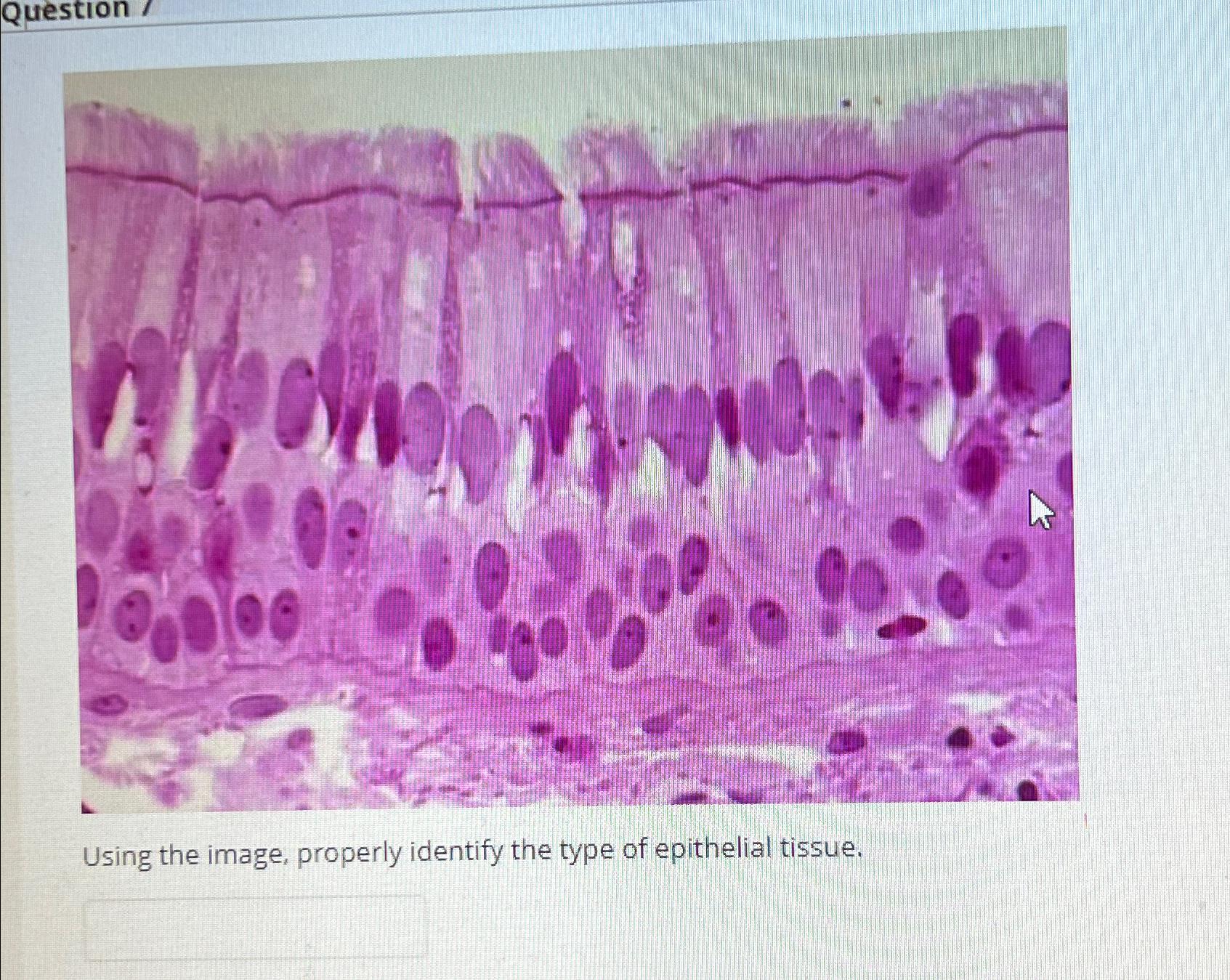 Solved Question /Using the image, properly identify the type | Chegg.com