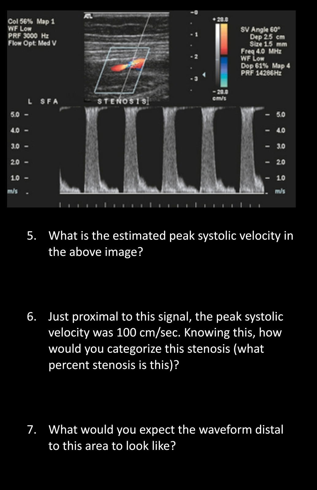 What Is Peak Systolic Velocity _ Perinatology Velocity – ETDKHL