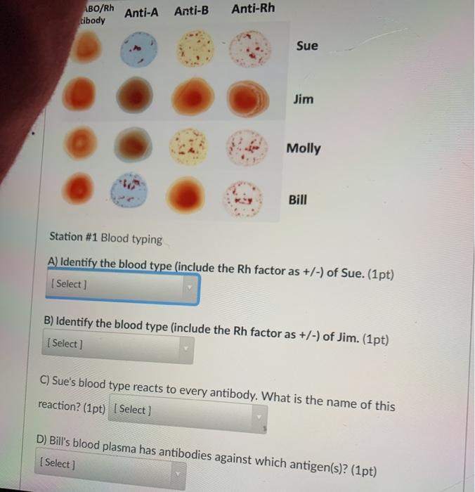 Solved ABO/Rh Tibody Anti-A Anti-B Anti-Rh Sue Jim Molly | Chegg.com