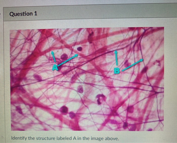 Solved Question 1 Identify The Structure Labeled A In The | Chegg.com