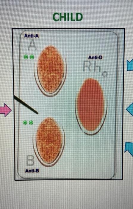 The Blood Typing Game - about blood groups, blood typing and blood  transfusions