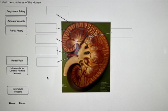 Solved Label the structures of the kidney. Segmental Artery | Chegg.com