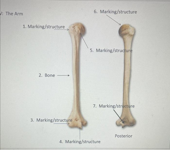 Solved v: The Arm 6. Marking/structure 1. Marking/structure | Chegg.com