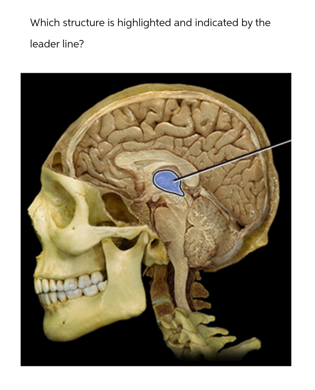 Solved Which structure is highlighted and indicated by the | Chegg.com