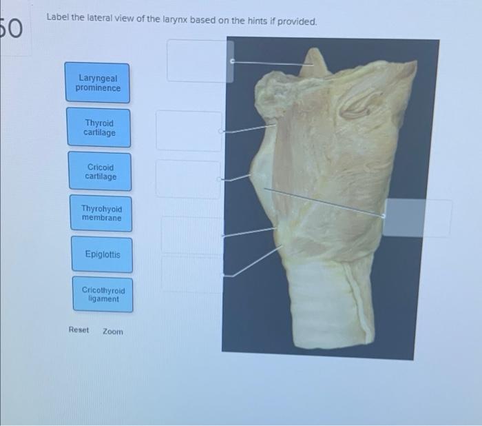 Solved Label The Lateral View Of The Larynx Based On The