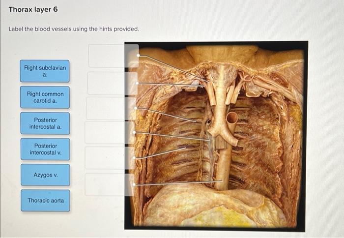 [Solved]: Thorax layer 6 Label the blood vessels using the