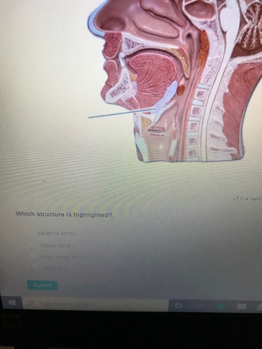 solved-which-structure-is-highlighted-1-palatine-tonsil2-chegg