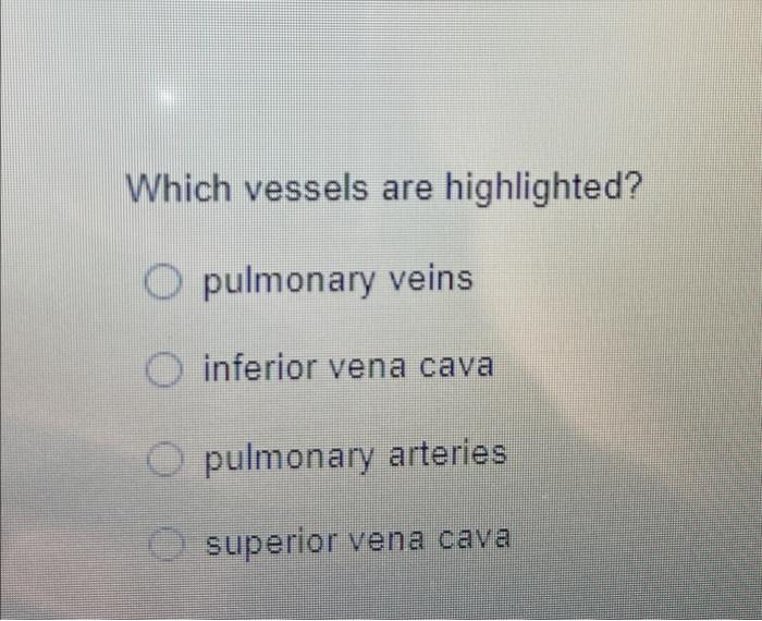 Which vessels are highlighted?
O pulmonary veins
inferior vena cava
pulmonary arteries
superior vena cava
