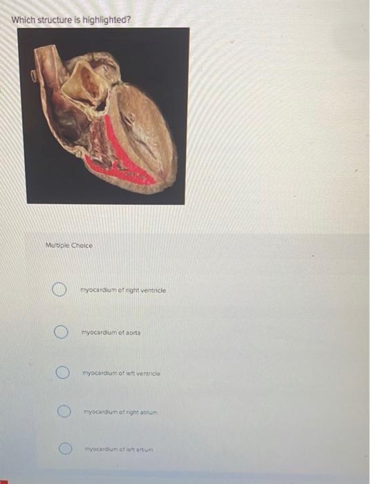 Which structure is highlighted?
Multiple Choice
O
myocardium of right ventricle
myocardium of aorta
myocardium of left ventri