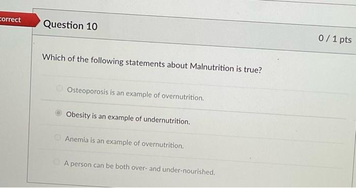 Solved Which of the following statements about Malnutrition | Chegg.com
