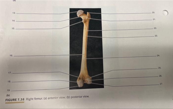 (b) FIGURE 7.38 Right femur. (a) anterior view; (b) posterior view.