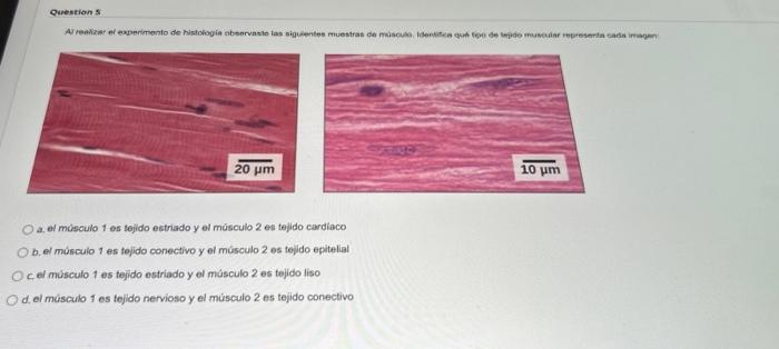 a. el músculo 1 es tejido estriado y el músculo 2 es tejido cardiaco b. el músculo 1 es tejido conectivo y el músculo 2 es te