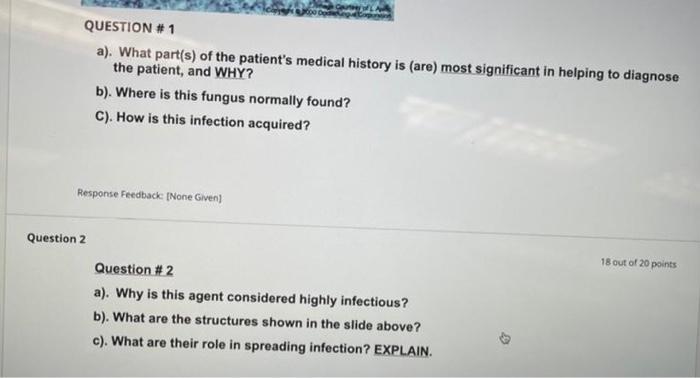 Solved Question 1 20 out of 20 points A 54 year old man | Chegg.com