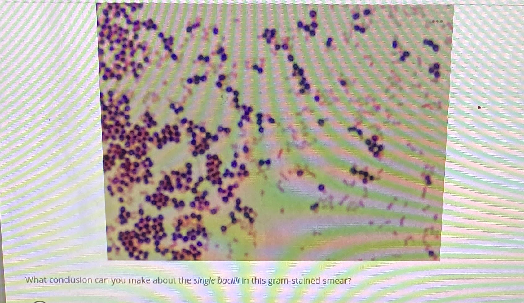 Solved What conclusion can you make about the single bacilli | Chegg.com