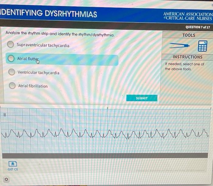 Solved IDENTIFYING DYSRHYTHMIAS AMERICAN ASSOCIATION | Chegg.com