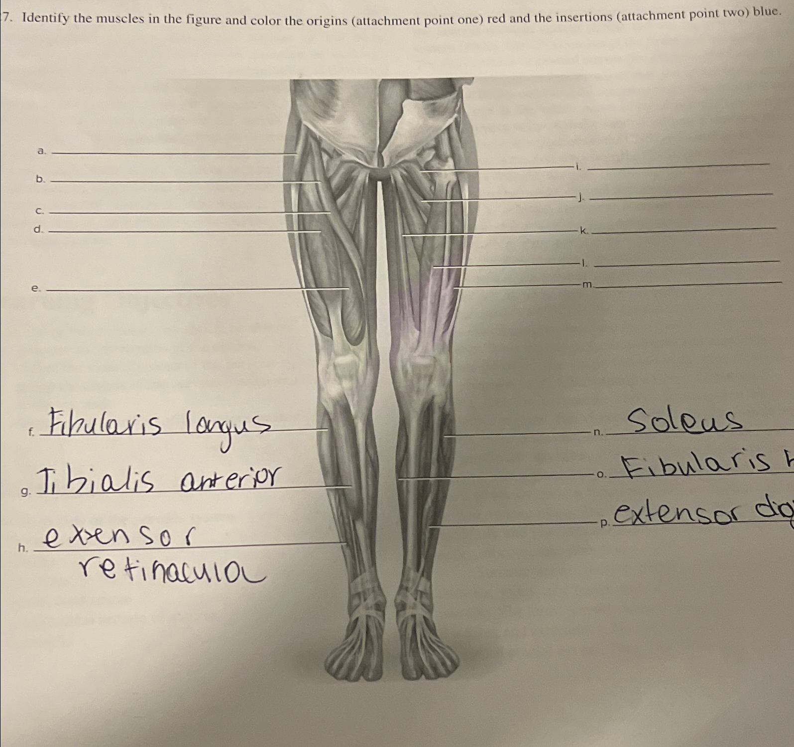 Solved Identify the muscles in the figure and color the | Chegg.com
