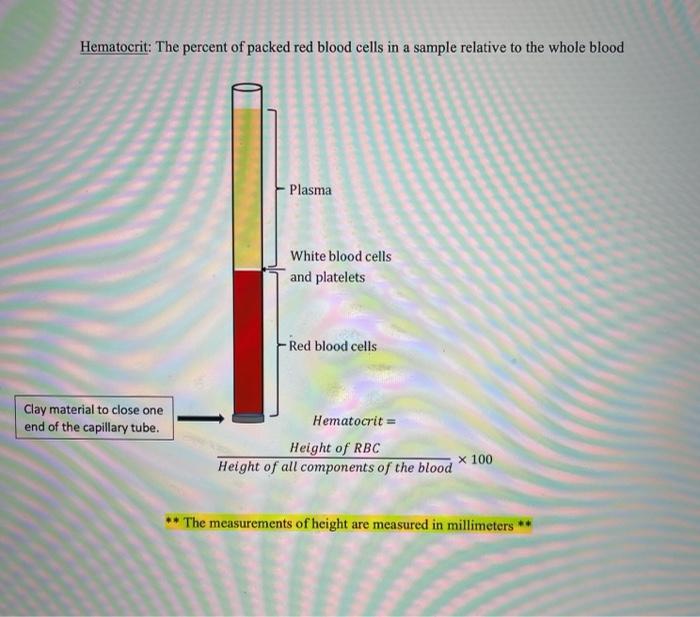Question Hematocrit The Percent Of Packed Red Blood Cells In A Sample