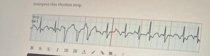 Interpret this rhythm strip | Chegg.com