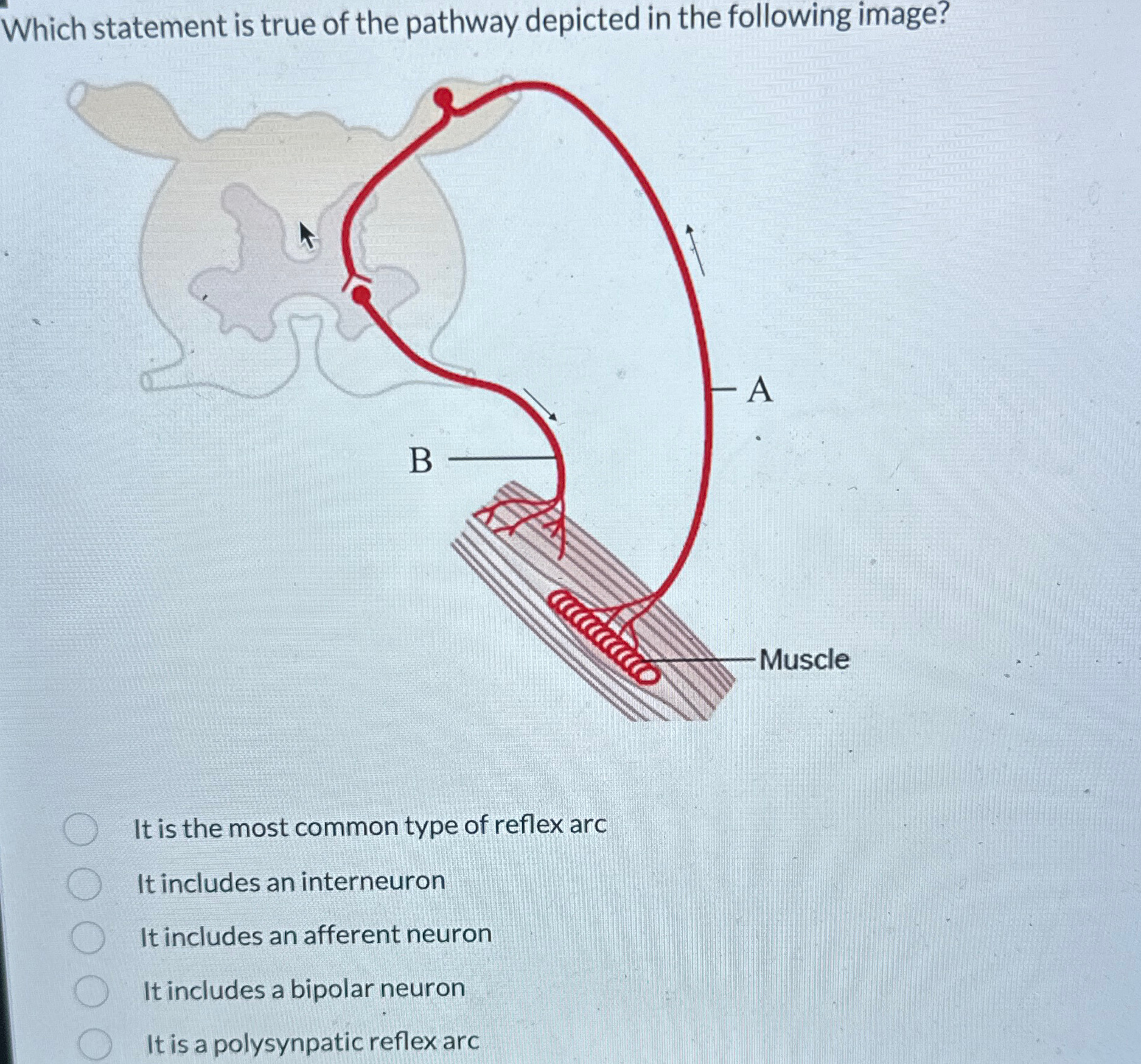 Solved Which statement is true of the pathway depicted in | Chegg.com