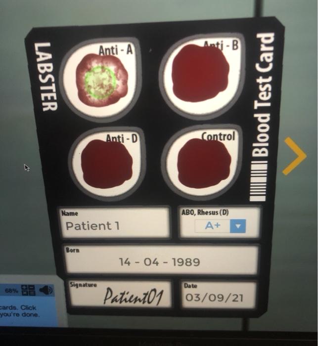 Solved AntiA AntiB LABSTER Blood Test Card AntiD