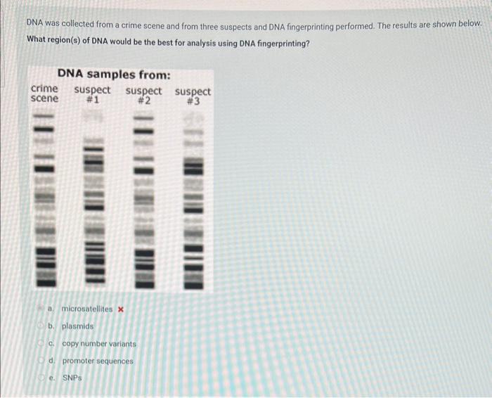 DNA was collected from a crime scene and from three suspects and DNA fingerprinting performed. The results are shown below. W