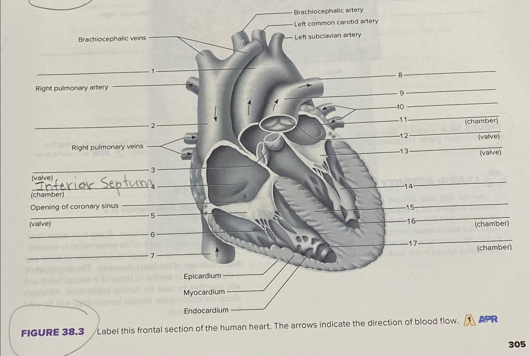 Solved FIGURE 38.3Label this frontal section of the human | Chegg.com