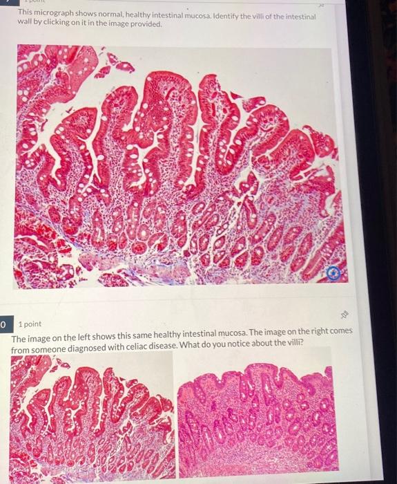 Solved identify the villi of the intestinal wall by clicking | Chegg.com