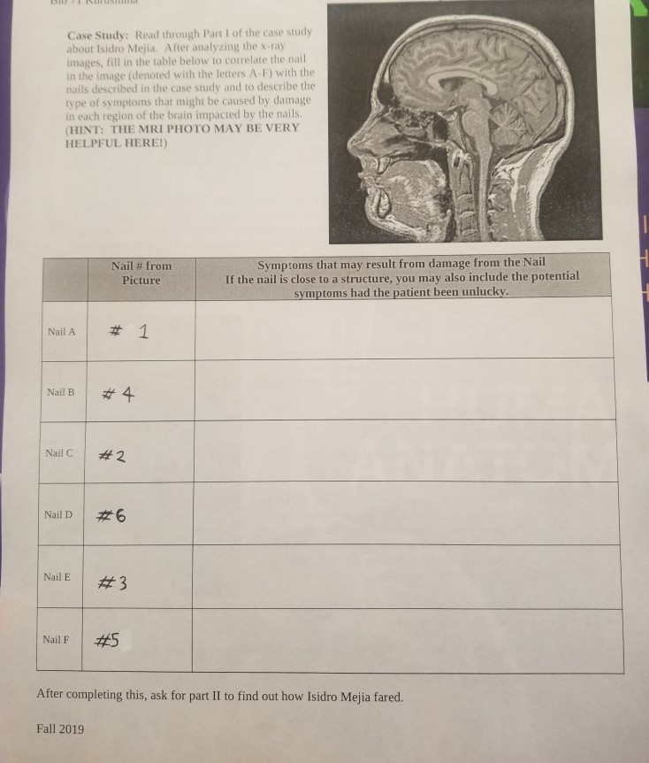 Solved Brain Structure and Function Case Study Partl On | Chegg.com