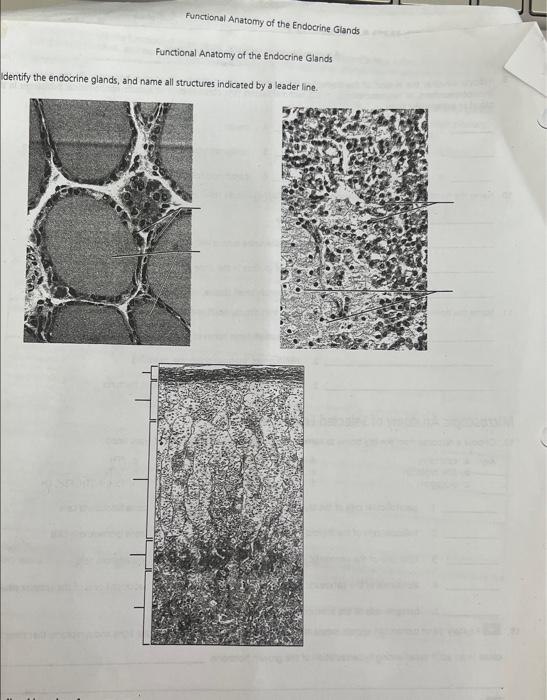 Functional Anatomy of the Endorrina ciland.9. | Chegg.com