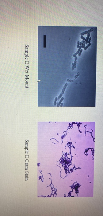 Solved Identifying Your Unknown Bacteria Step 1: Gram Stain | Chegg.com