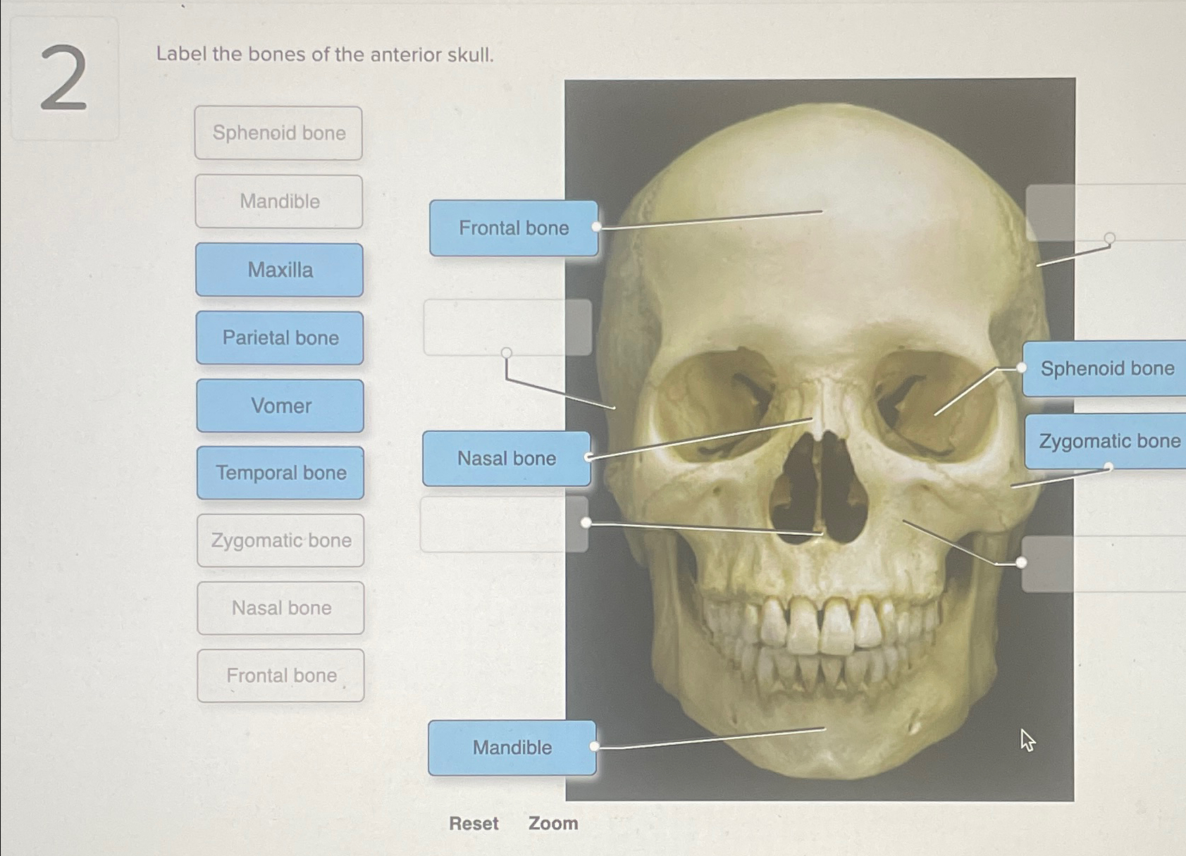 Solved Label the bones of the anterior skull.ResetZoom | Chegg.com