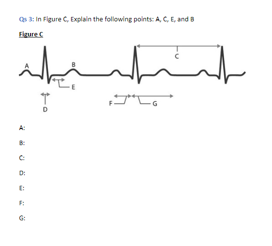 Solved Qs 3: In Figure C, ﻿Explain the ECG points: Figure | Chegg.com