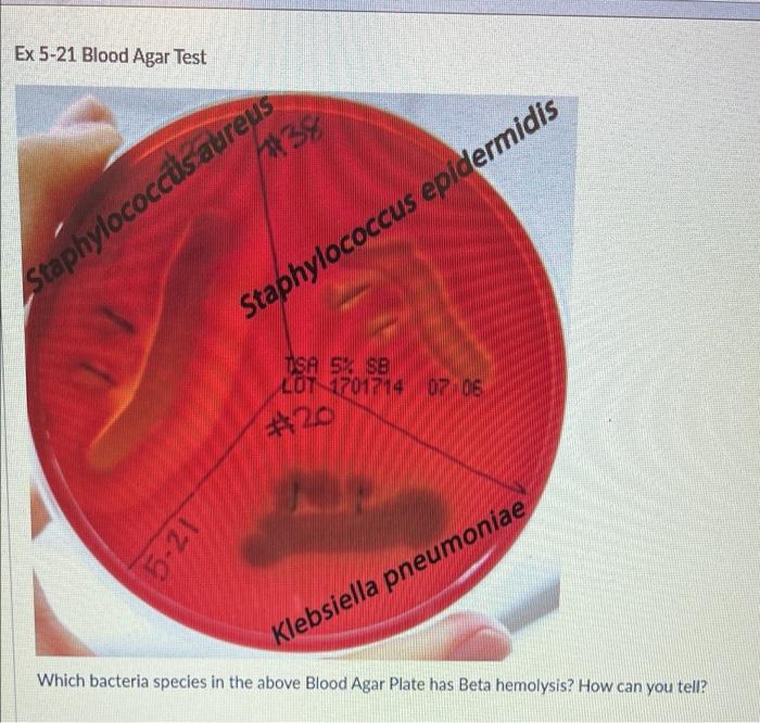 Solved Ex 521 Blood Agar Test 38 Staphylococcus epidermidis