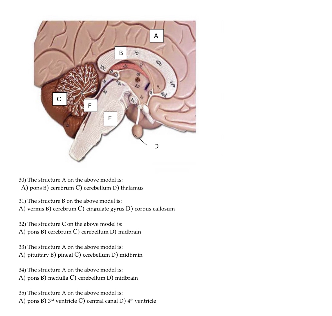 Solved The structure A on the above model is:A) ﻿pons B) | Chegg.com