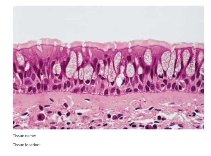 Solved Tissue Name: Tissue Location (only 1): Tissue | Chegg.com