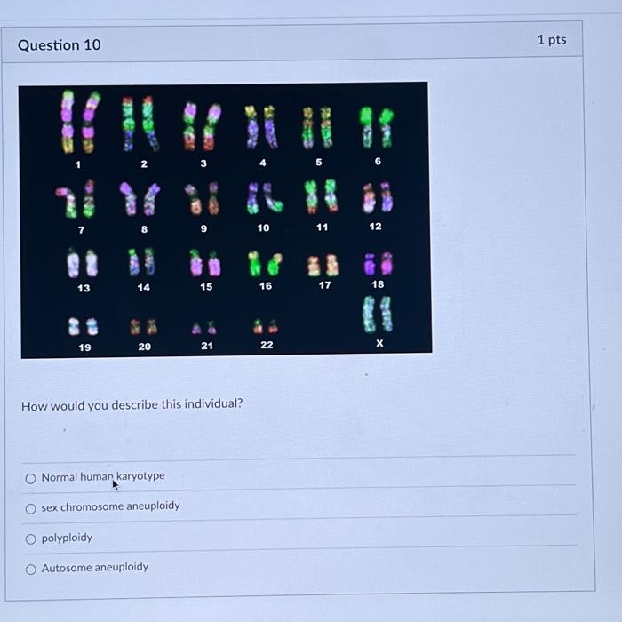 Solved Question 10 13 19 14 20 Normal Human Karyotype O Sex 5282