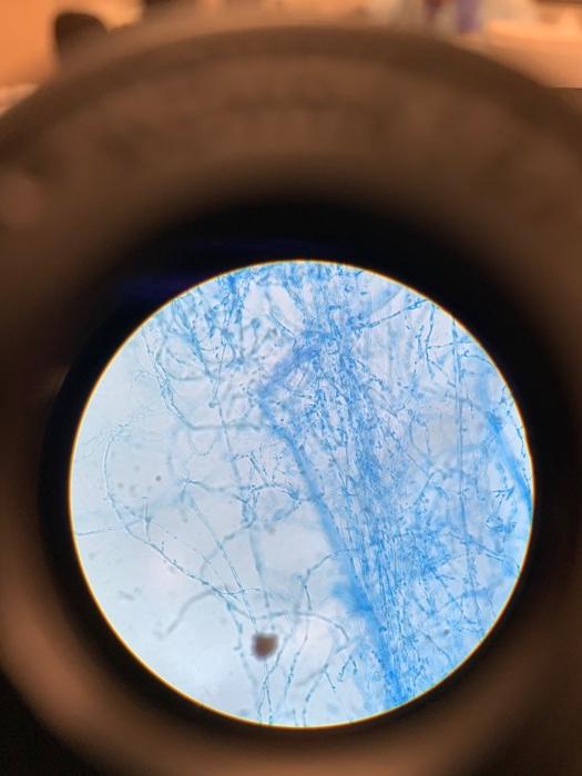 Solved microscopic mold sampleI have included photos taken | Chegg.com