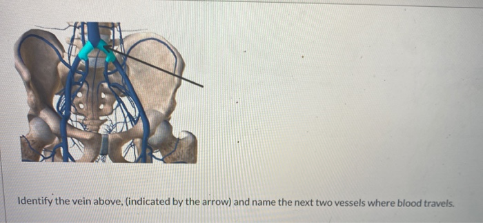 Solved Identify the vein above, (indicated by the arrow) and | Chegg.com