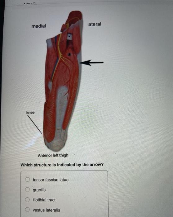 Solved medial lateral knee Anterior left thigh Which | Chegg.com