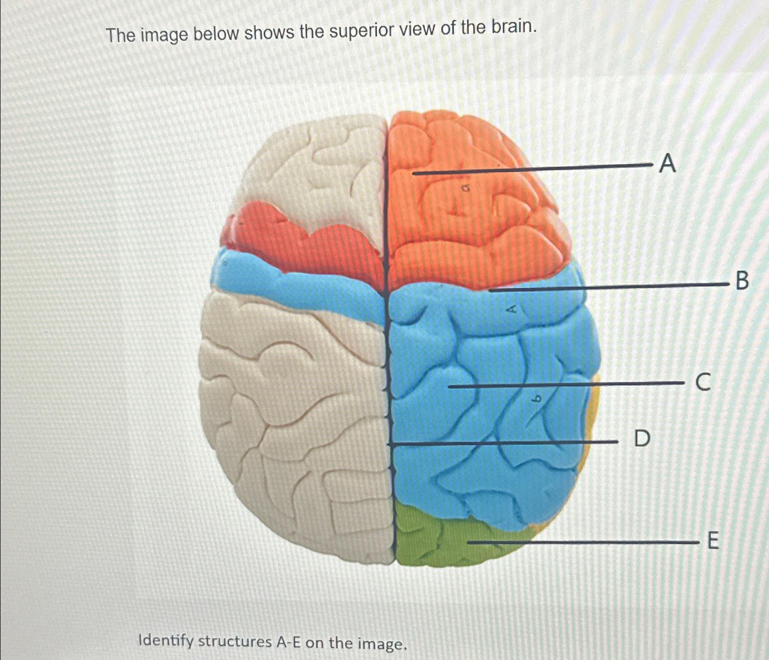 Solved The image below shows the superior view of the | Chegg.com