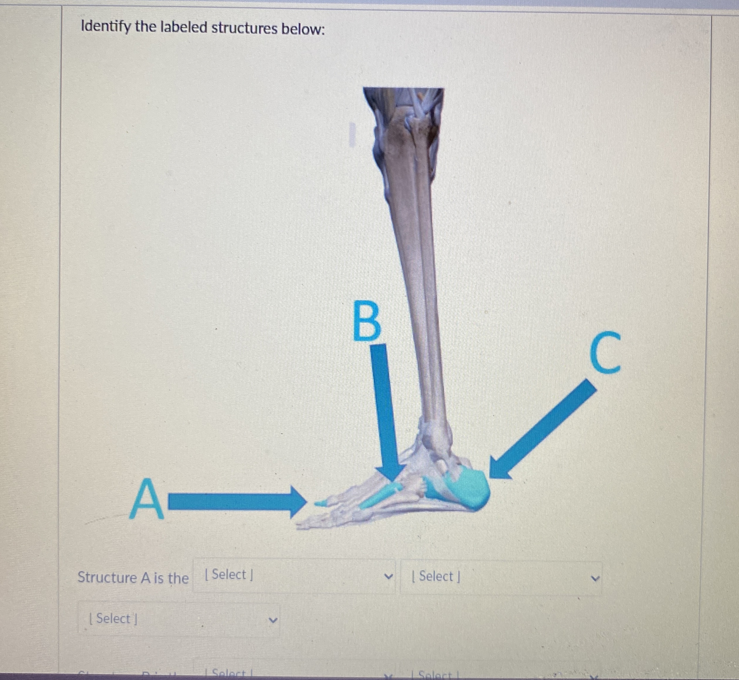 Solved Identify the labeled structures below:BStructure A | Chegg.com